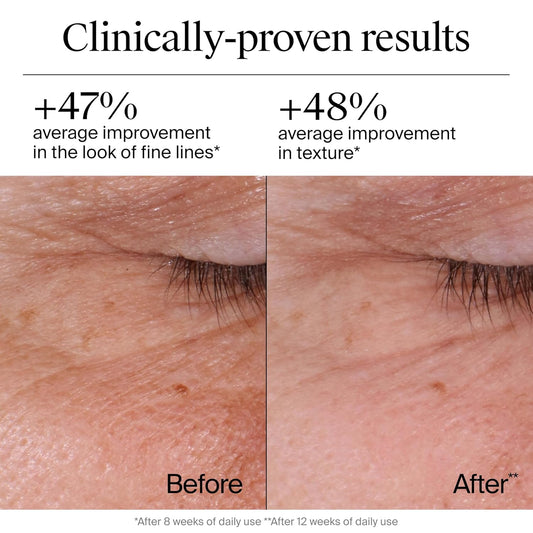 Neutrogena Rapid Wrinkle Repair Retinol Face Moisturizer – Anti-Aging Cream with Retinol & Hyaluronic Acid for Fine Lines, Wrinkles & Dark Spots (1.7 oz)