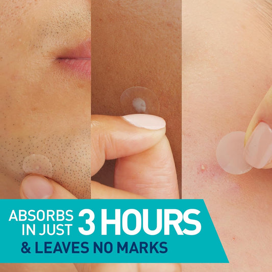 CeraVe Blemish Barrier Patches – Hydrocolloid Acne Spot Treatment with Ceramides & Niacinamide, Ultra-Thin & Gentle for Sensitive Skin (22ct)